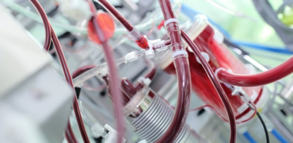 Sistema para Cardioplegia Sanguínea  com Permutador - Cath-Care